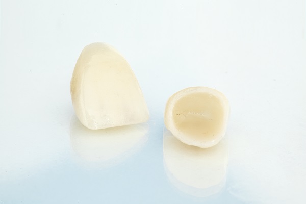 Popular Dental Crown Materials