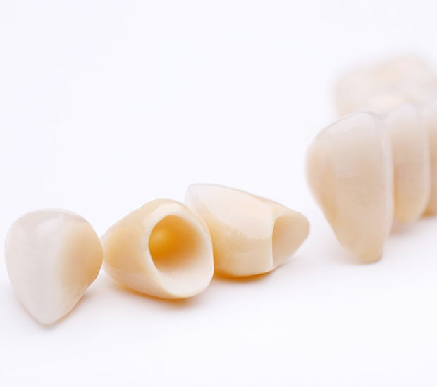 Canon City Dental Crowns and Dental Bridges