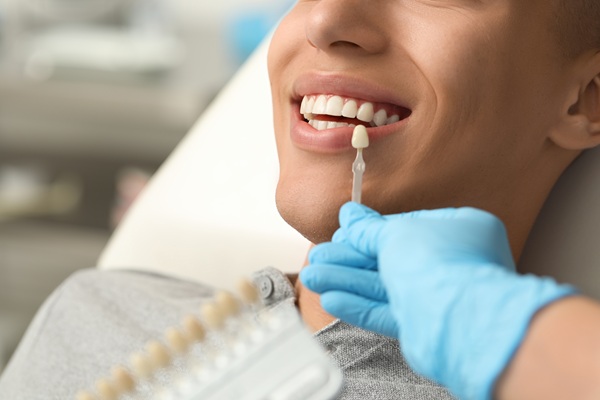 How To Care For Your Dental Veneers