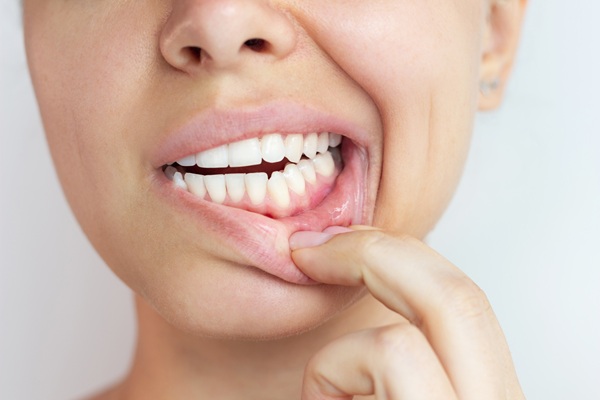 Silent And Dangerous: The Impact Of Gum Disease On Your Health